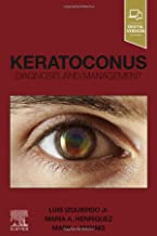 Keratoconus: Diagnosis and Management