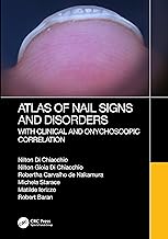 Atlas of Nail Signs and Disorders with Clinical and Onychoscopic Correlation