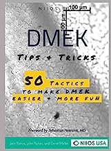 DMEK Tips & Tricks: 50 tactics to make DMEK easier and more fun