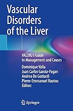 Vascular Disorders of the Liver: Valdig's Guide to Management and Causes