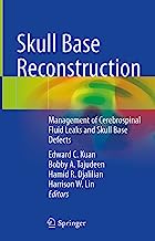 Skull Base Reconstruction: Management of Cerebrospinal Fluid Leaks and Skull Base Defects