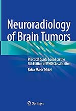 Neuroradiology of Brain Tumors: Practical Guide Based on the Who Molecular Classification