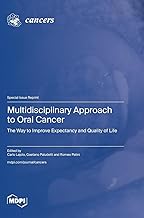 Multidisciplinary Approach to Oral Cancer: The Way to Improve Expectancy and Quality of Life