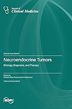 Neuroendocrine Tumors: Etiology, Diagnosis, and Therapy