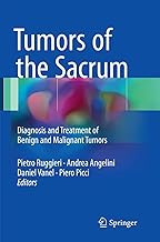 Tumors of the Sacrum: Diagnosis and Treatment of Benign and Malignant Tumors