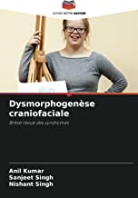 Dysmorphogenèse craniofaciale: Brève revue des syndromes