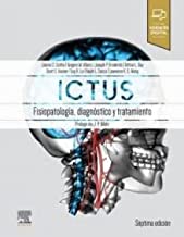 Ictus: Fisiopatología, diagnóstico y abordaje: Patofisiología, diagnóstico y manejo