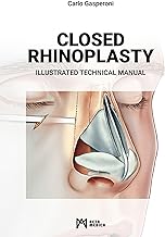 Closed rhinoplasty. Illustrated technical manual