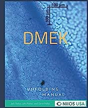 DMEK Unfolding Manual