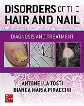 Disorders of the Hair and Nail: Diagnosis and Treatment