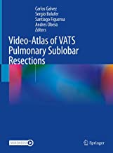 Video-atlas of Vats Pulmonary Sublobar Resections