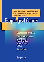 Esophageal Cancer: Diagnosis and Treatment