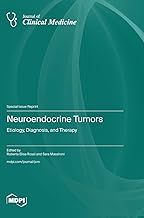 Neuroendocrine Tumors: Etiology, Diagnosis, and Therapy