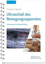 Ultraschall des Bewegungsapparates: Praxishandbuch mit Vergleichsbildern