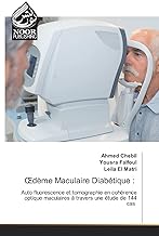 OEdème Maculaire Diabétique :: Auto fluorescence et tomographie en cohérence optique maculaires à travers une étude de 144 cas
