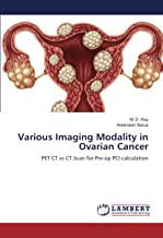 Various Imaging Modality in Ovarian Cancer: PET CT vs CT Scan for Pre-op PCI calculation