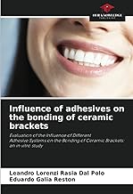 Influence of adhesives on the bonding of ceramic brackets: Evaluation of the Influence of DifferentAdhesive Systems on the Bonding of Ceramic Brackets: an in vitro study