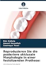 Reproduzieren Sie die posteriore okklusale Morphologie in einer festsitzenden Prothese:: Von klassisch bis digital