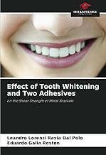 Effect of Tooth Whitening and Two Adhesives: on the Shear Strength of Metal Brackets