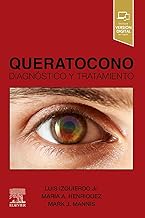 Queratocono: Diagnóstico y tratamiento