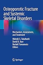 Osteoporotic Fracture and Systemic Skeletal Disorders: Mechanism, Assessment, and Treatment